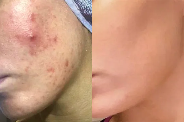 <p><span style="font-size: 12px;">BEFORE → AFTER</span> </p>